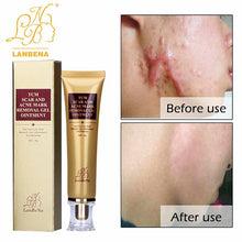 ACNE SCAR REMOVAL CREAM